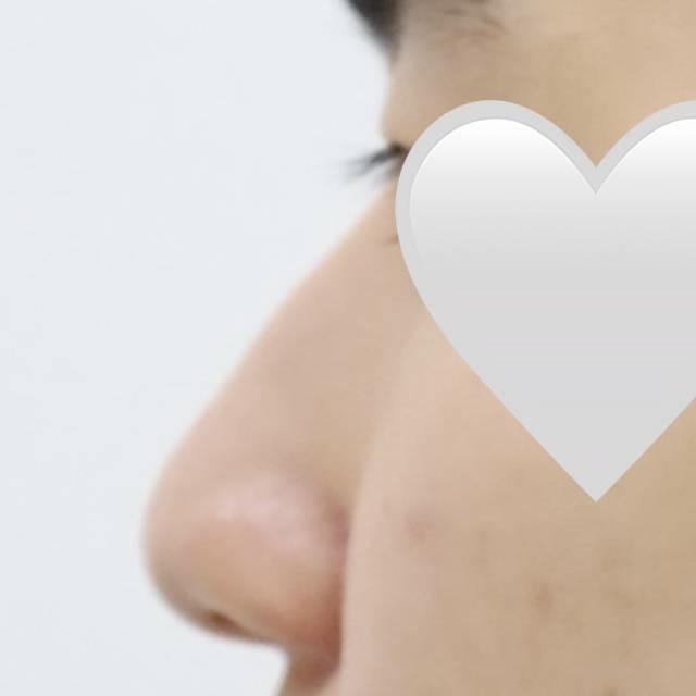 後