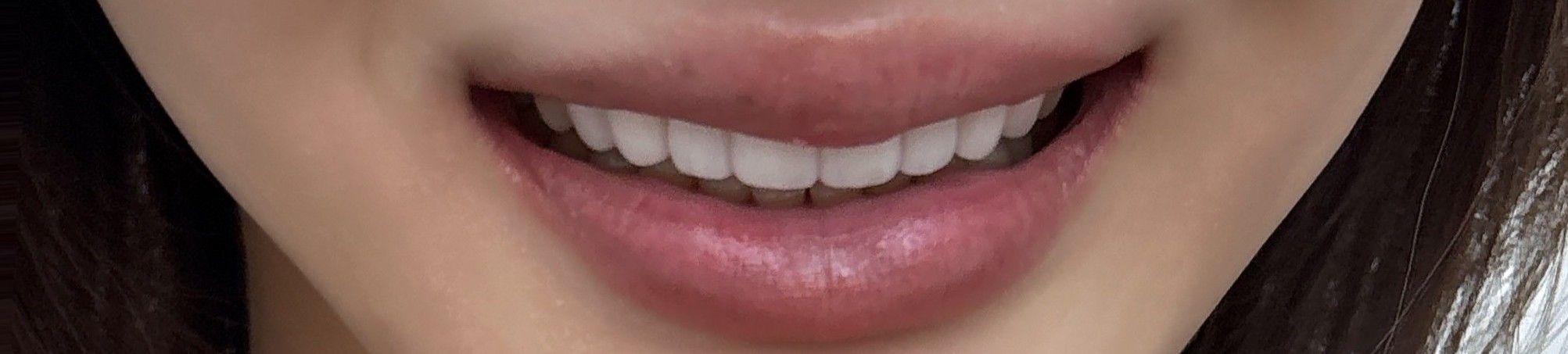 後