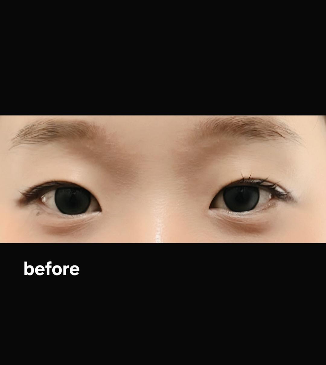 後