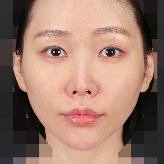 後