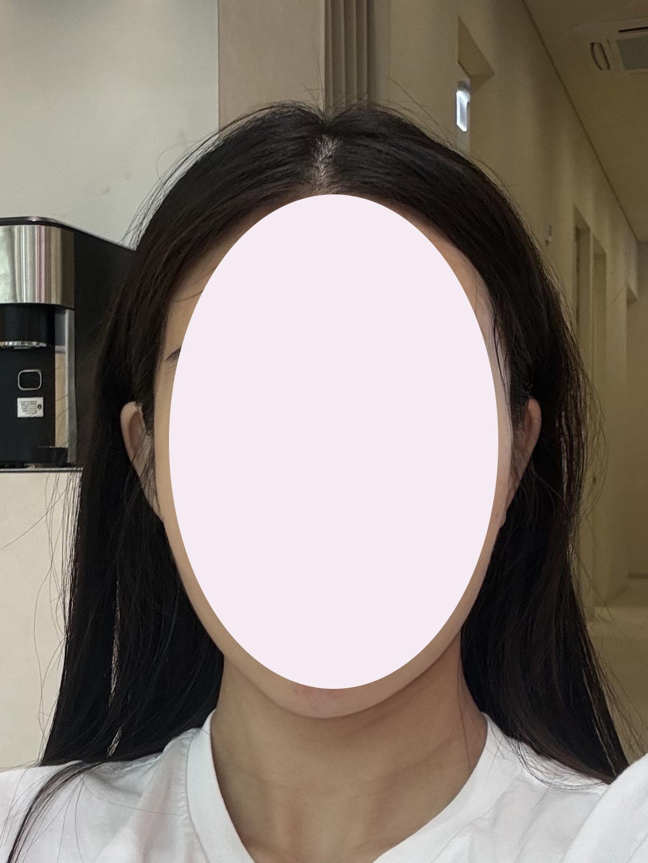 前