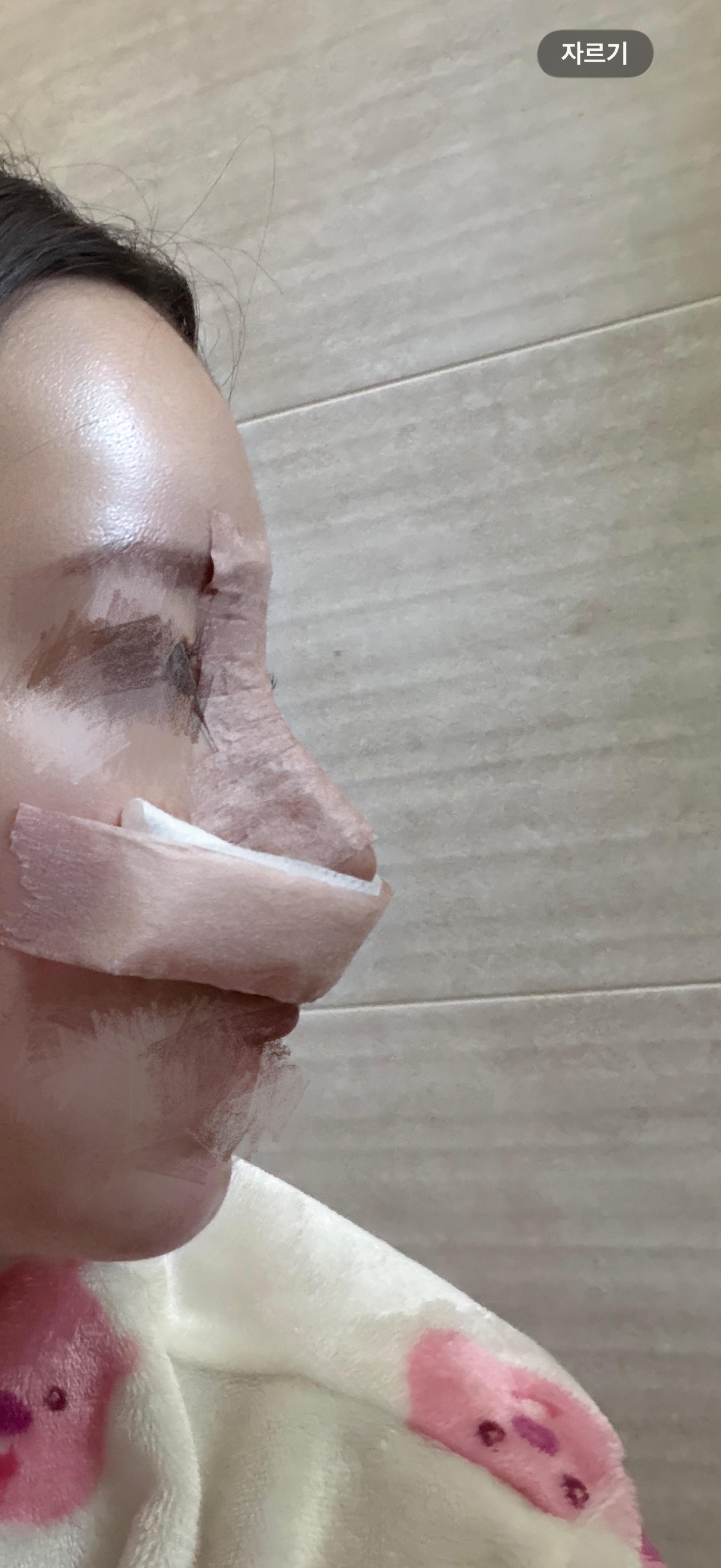 後