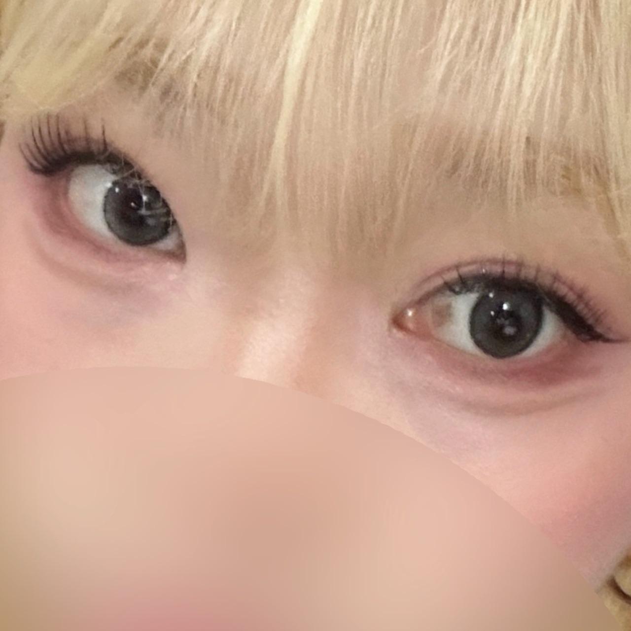 後