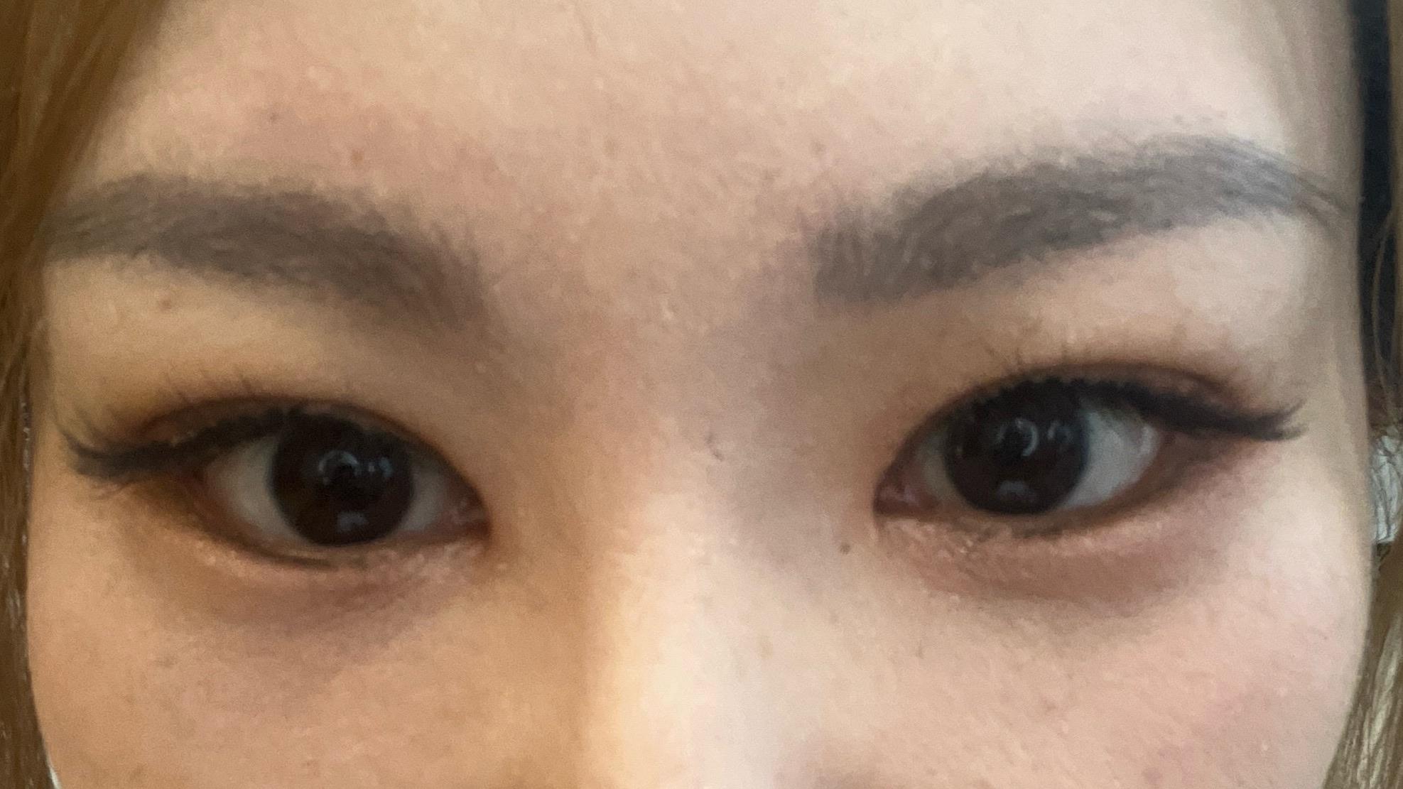 後