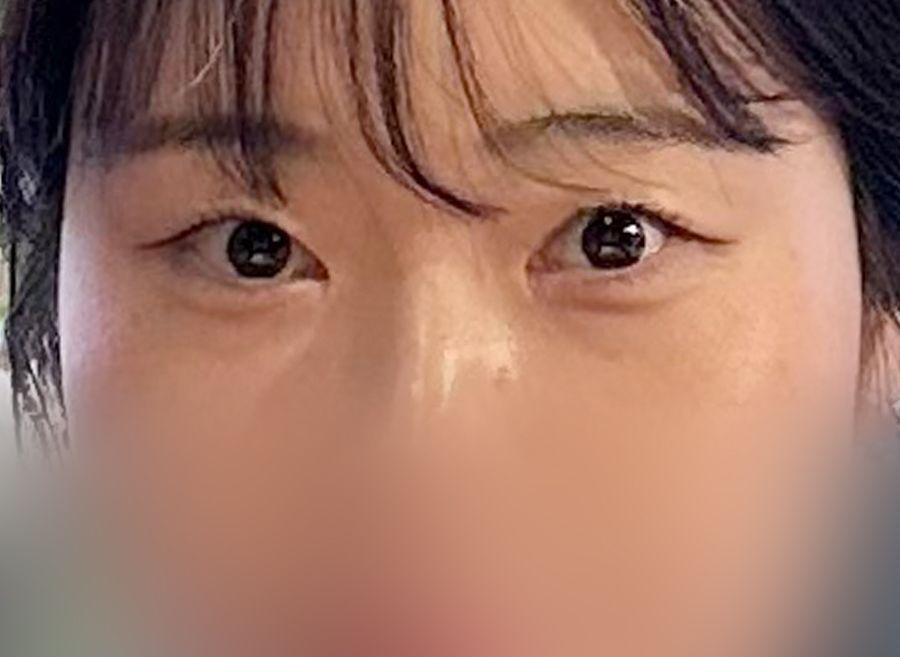 後