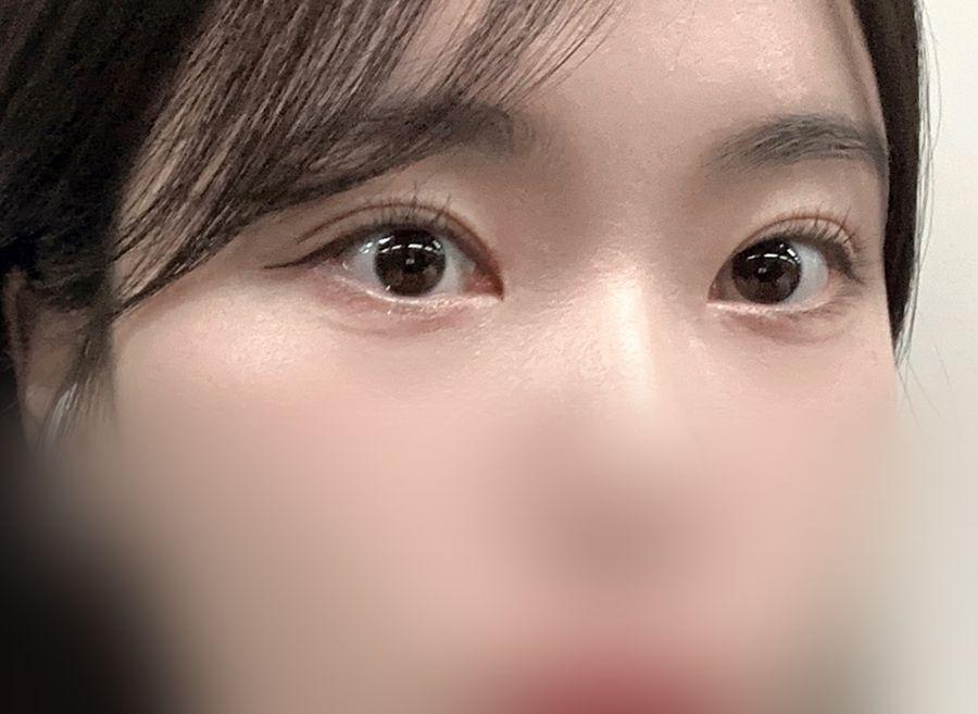 後