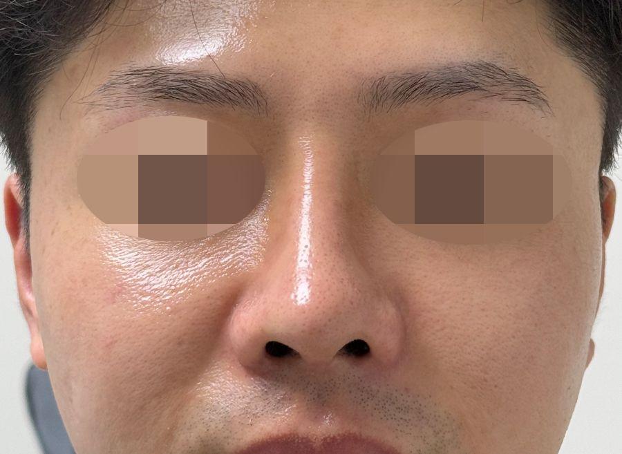 後