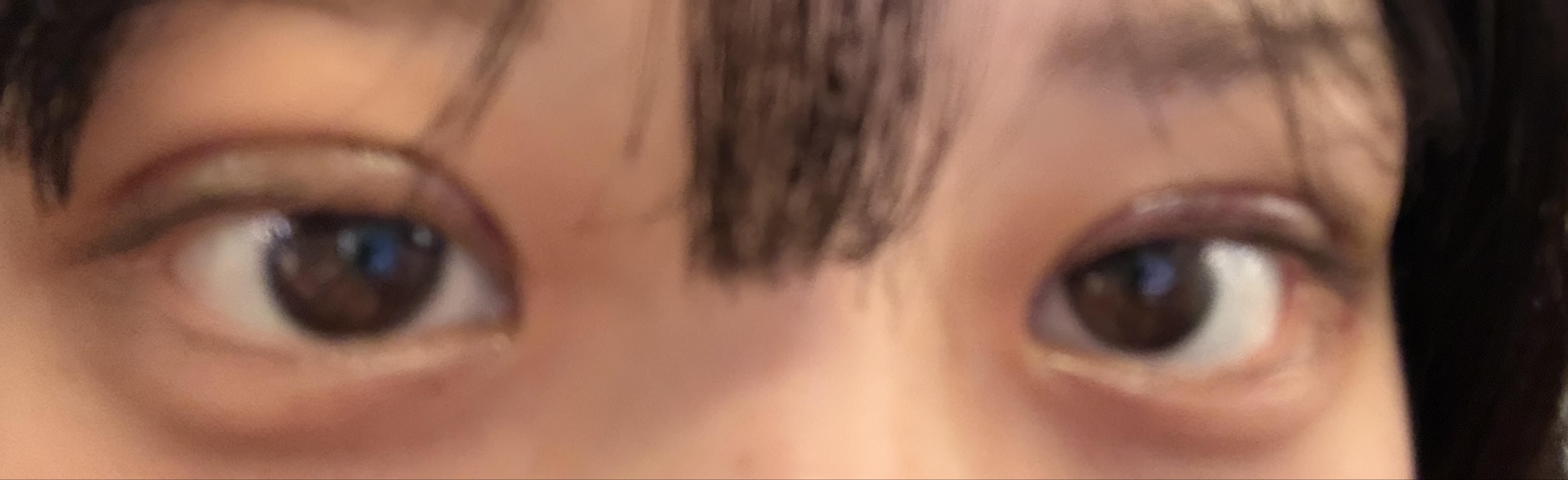 後