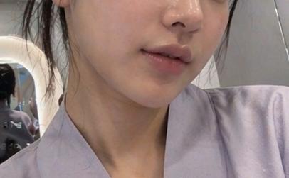後