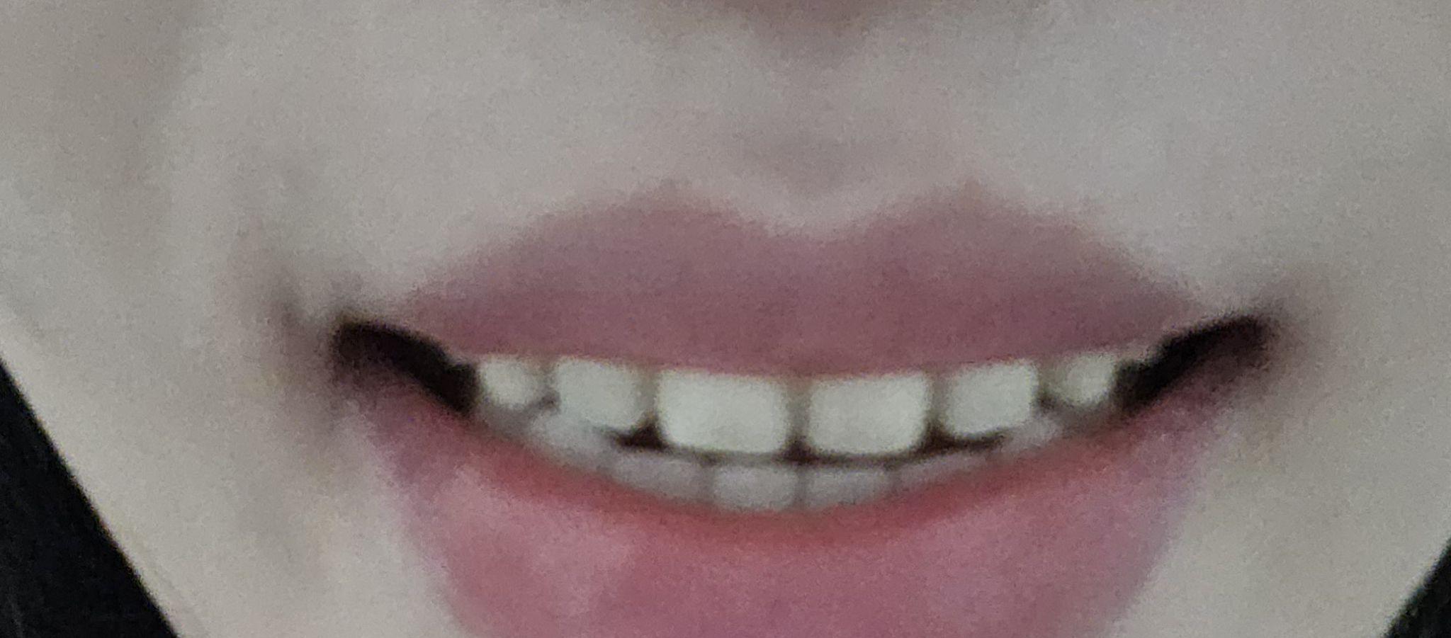 後