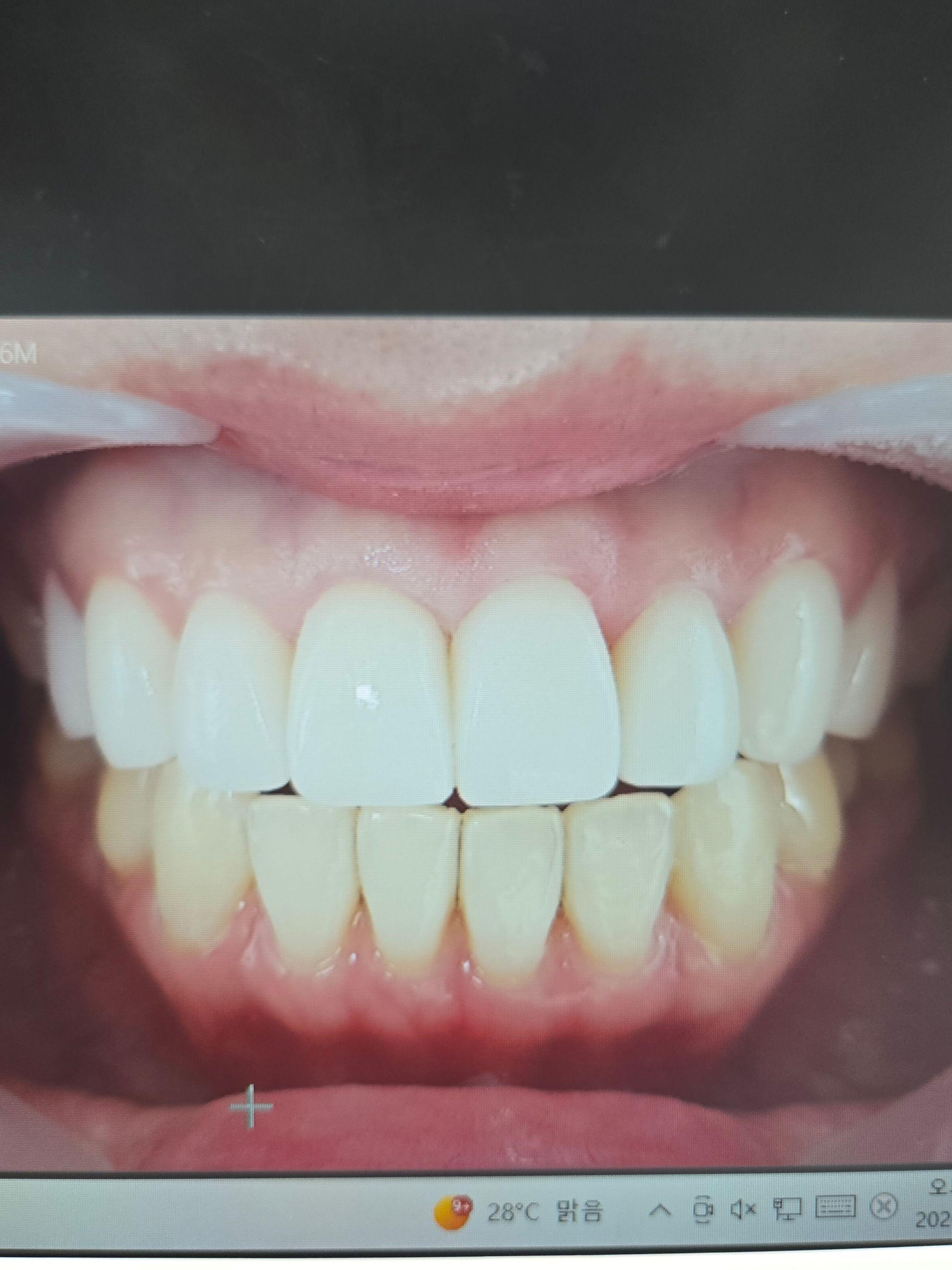 後