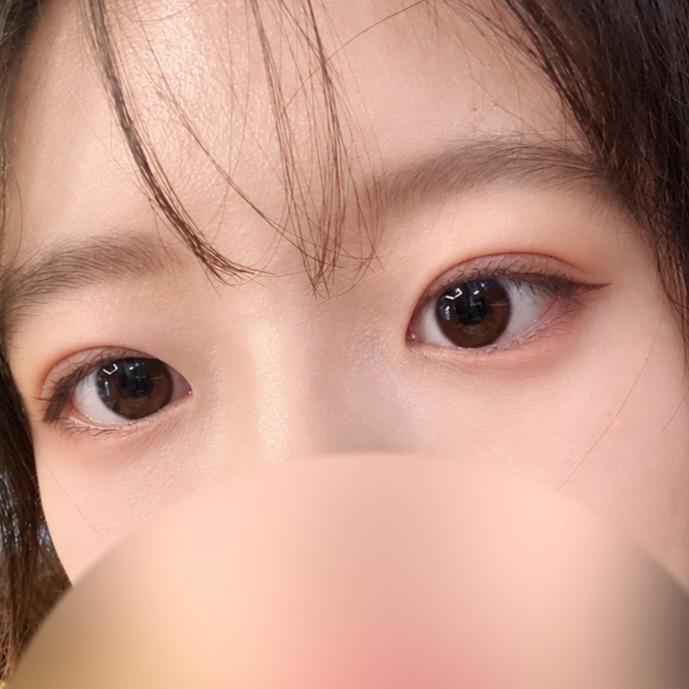 後