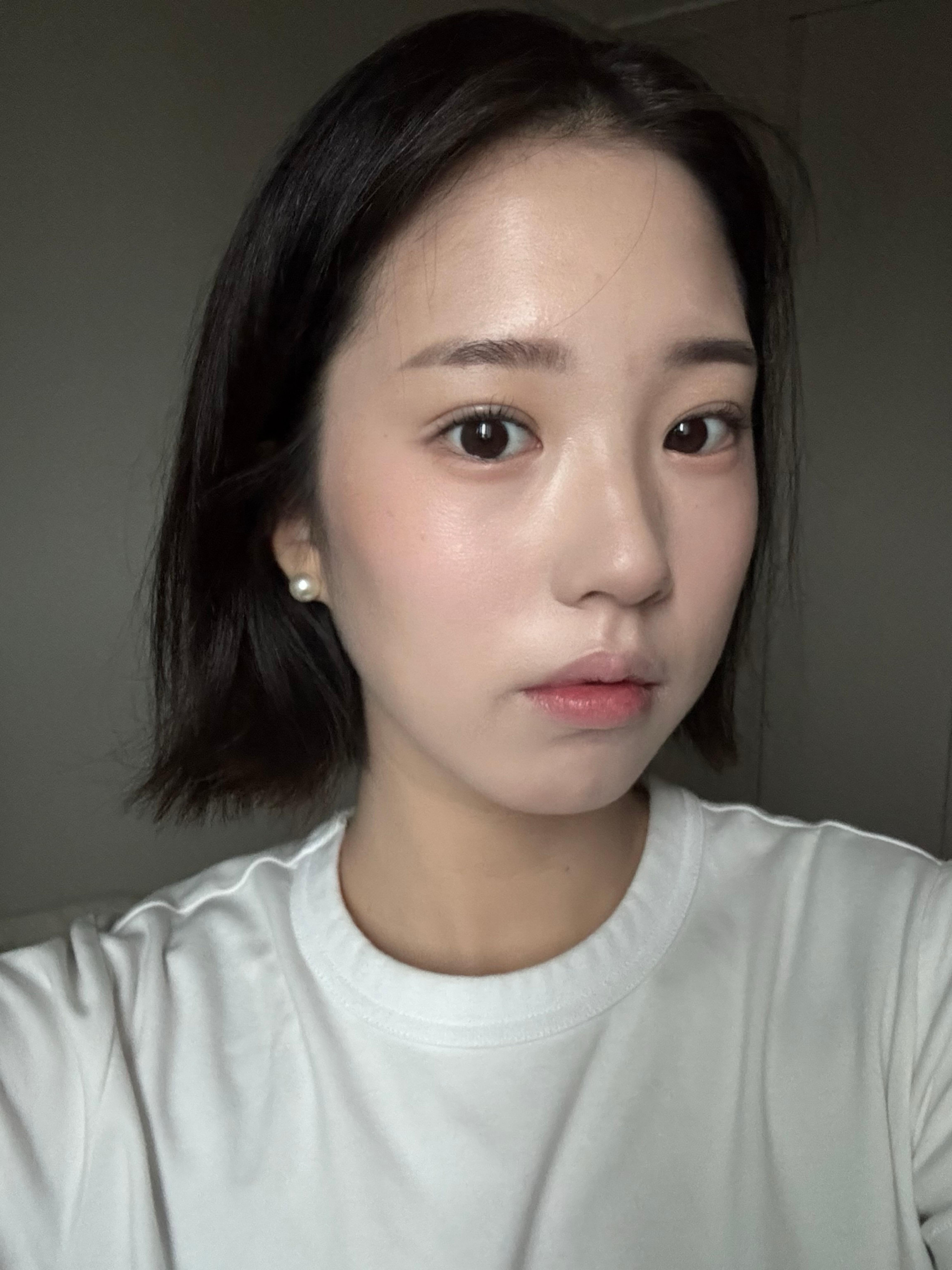 後