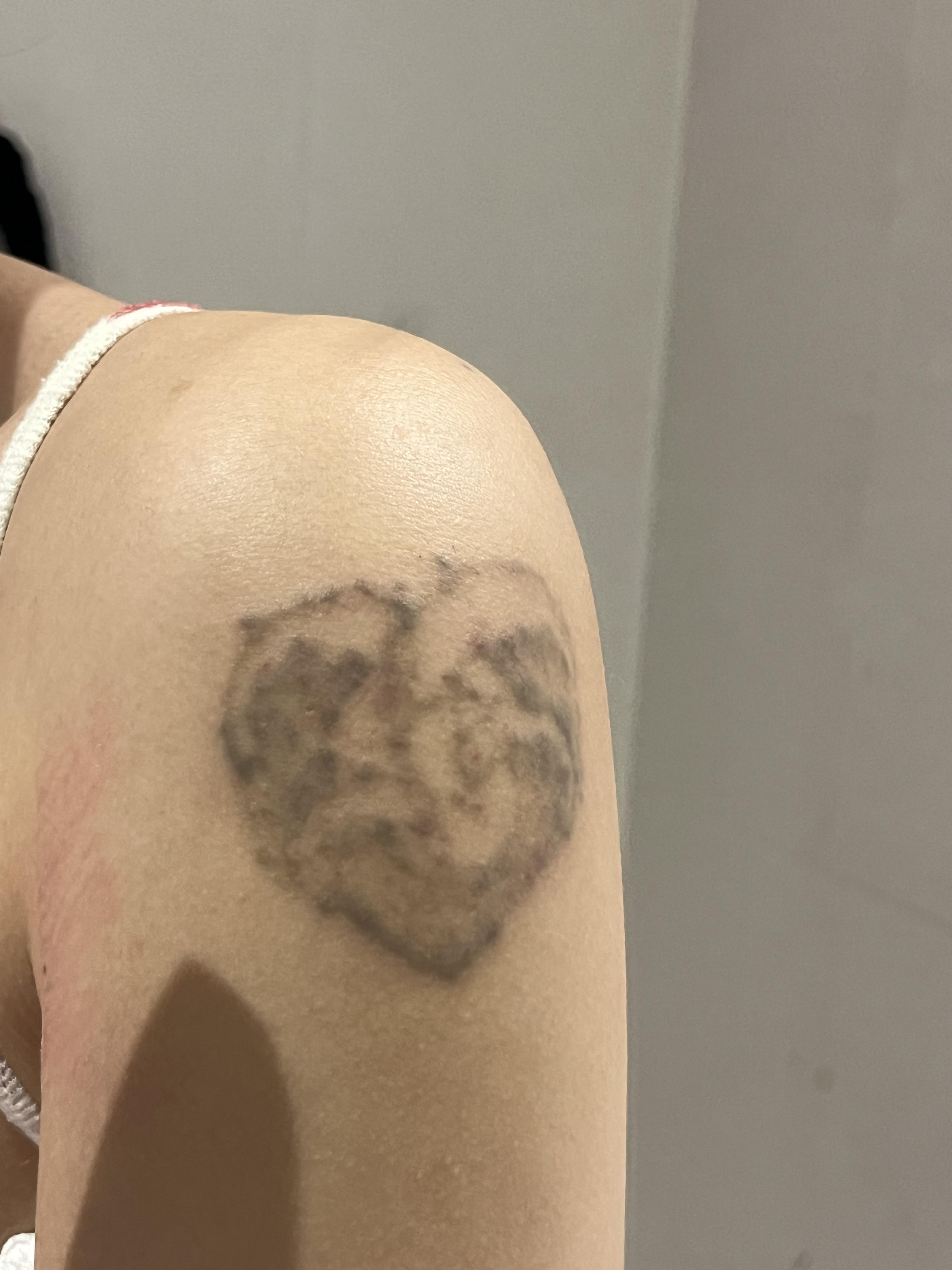 後