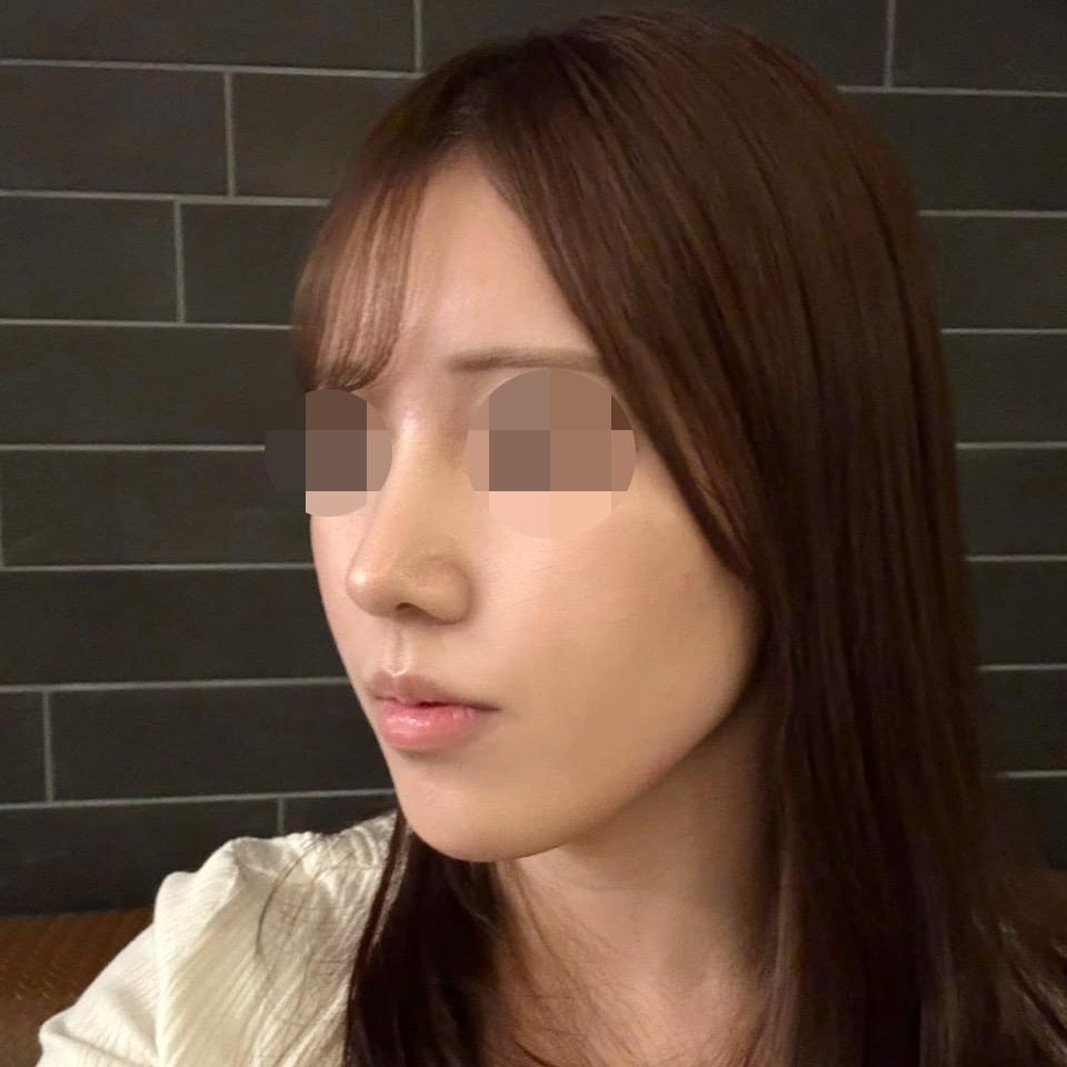 後