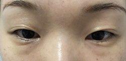 後