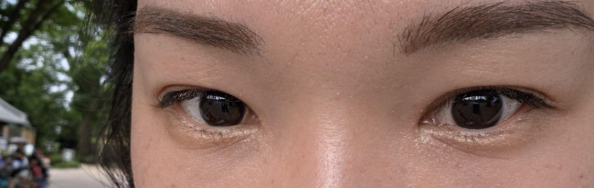 後