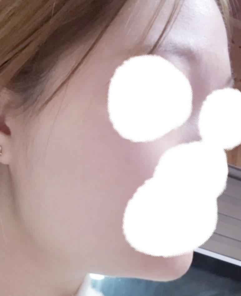 後