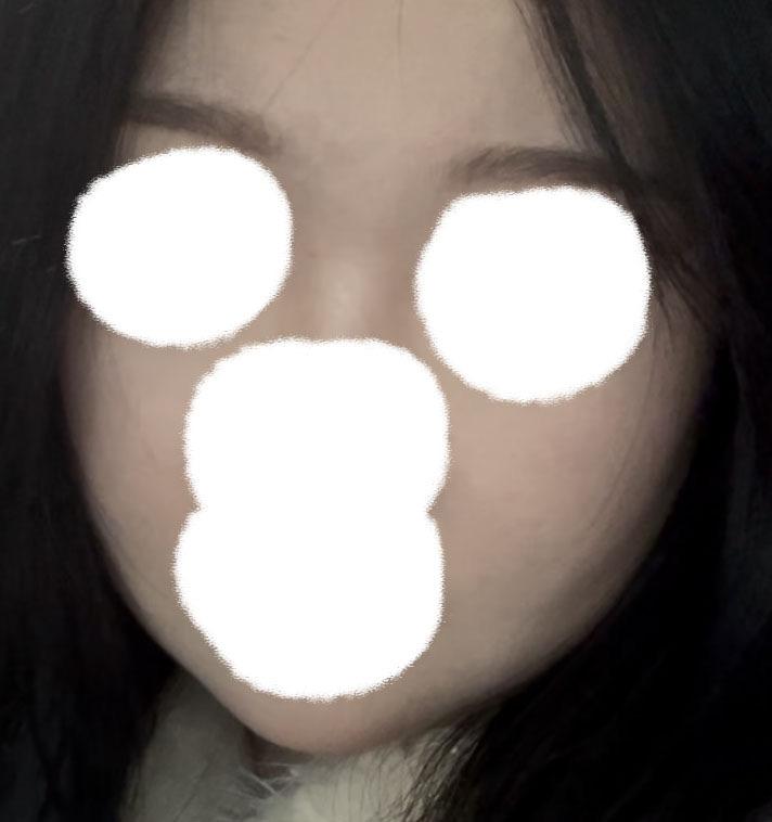 後