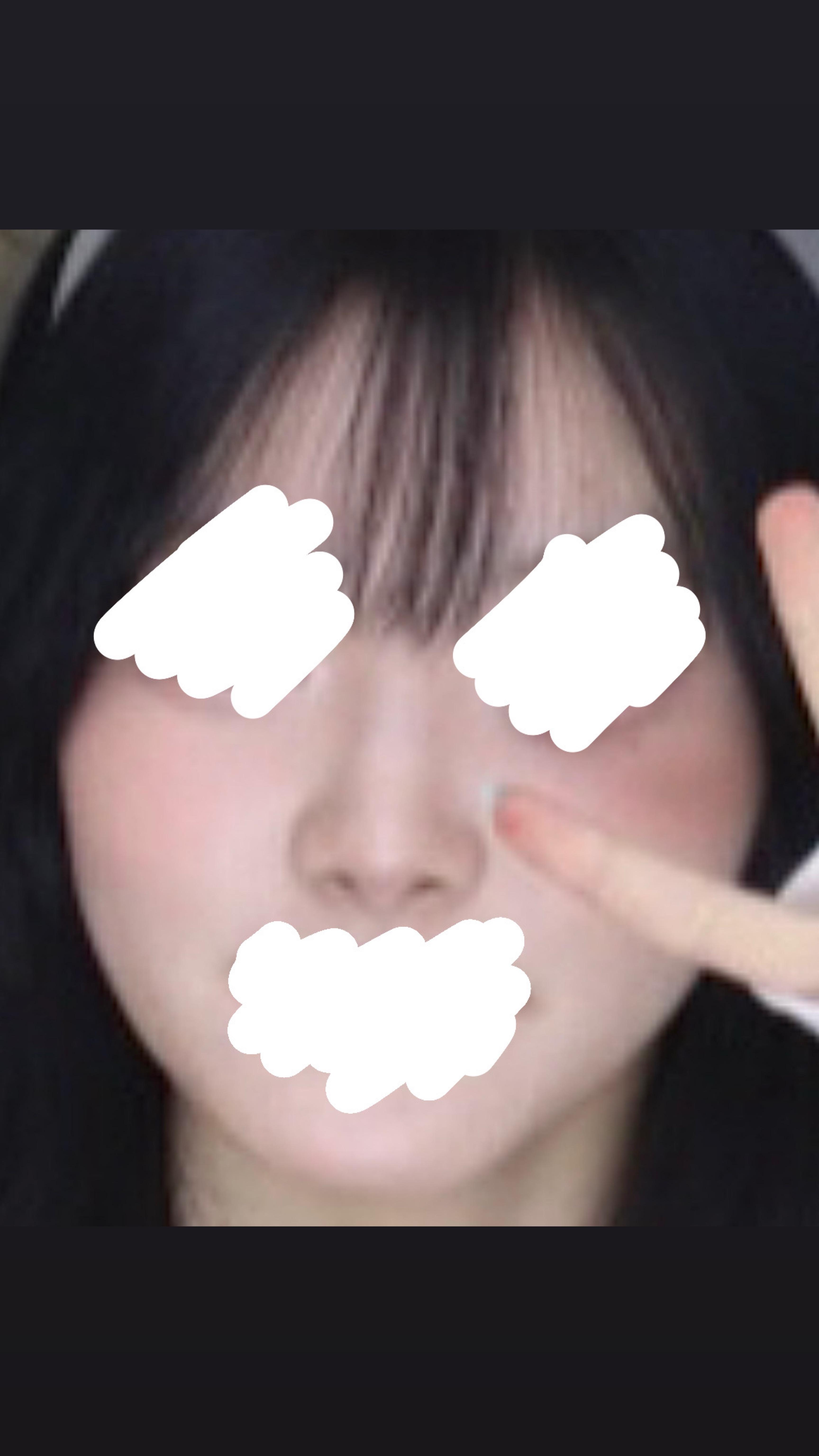後