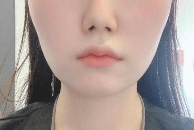 前