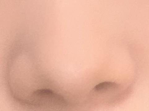 後
