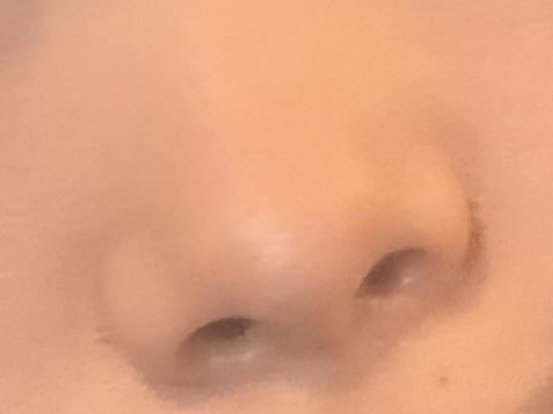 後