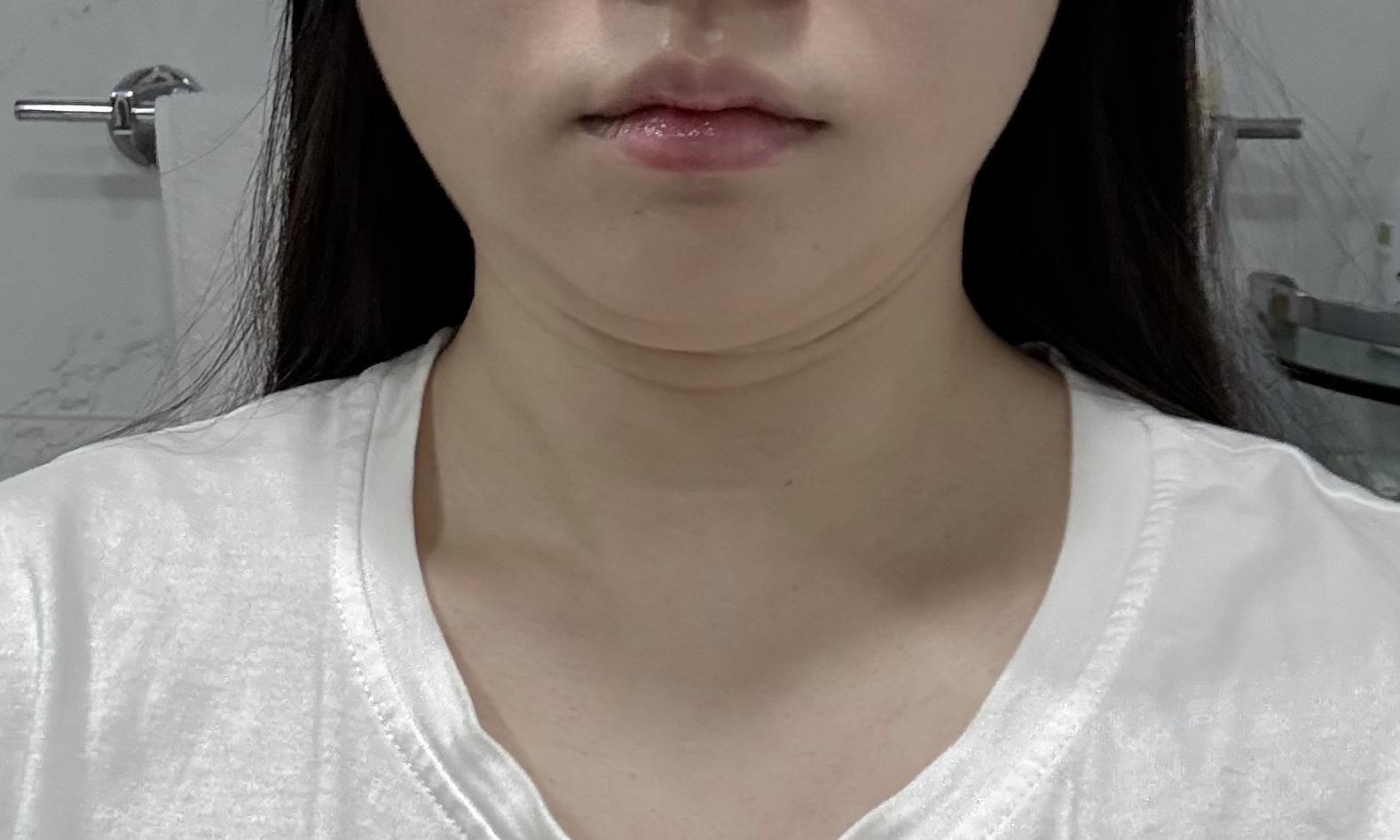 後