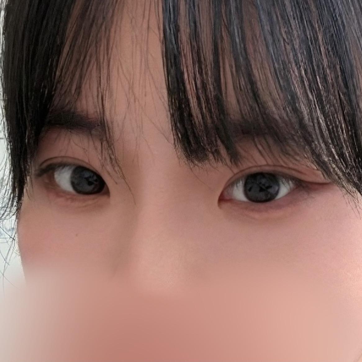 後