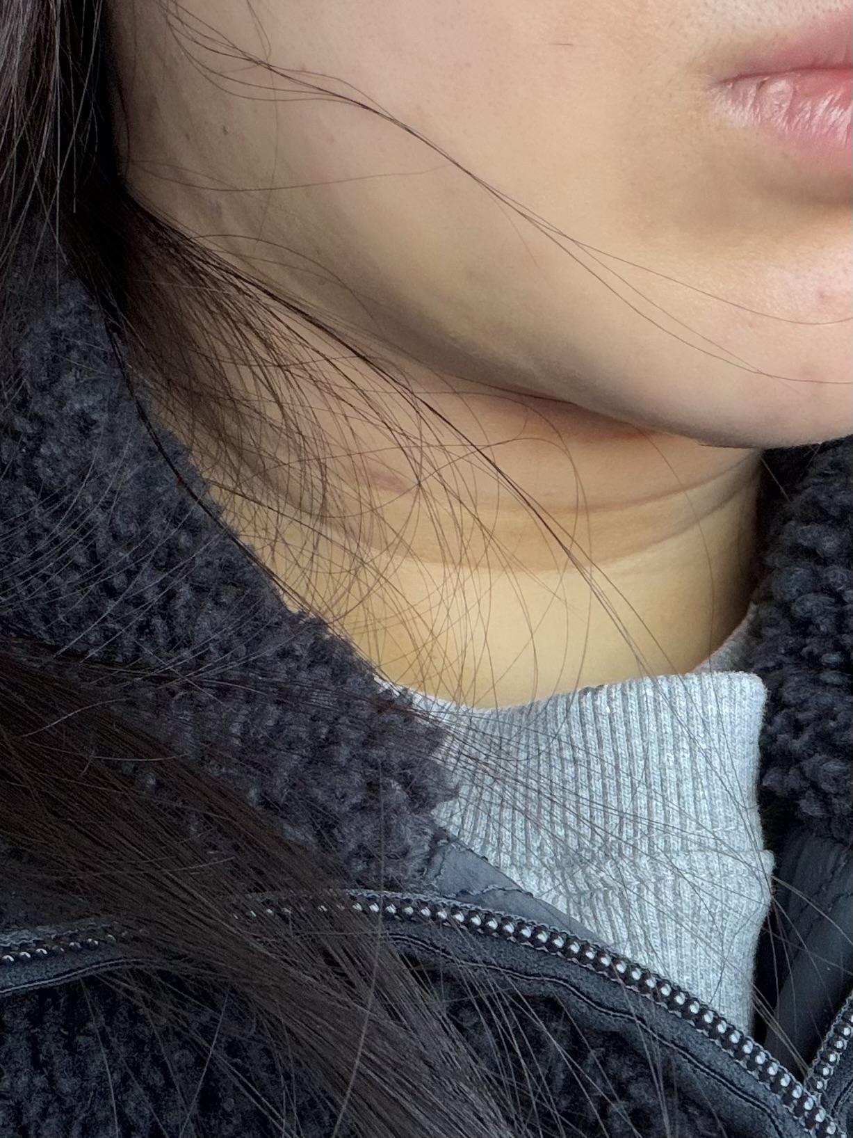 後