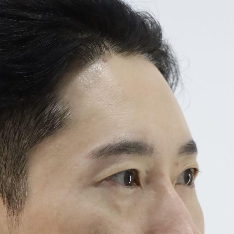 後