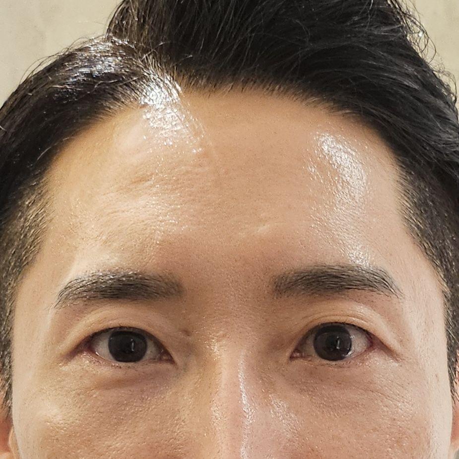 後