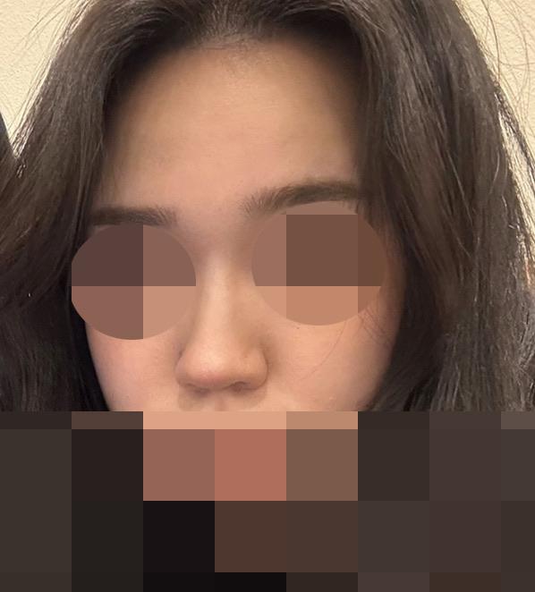 後