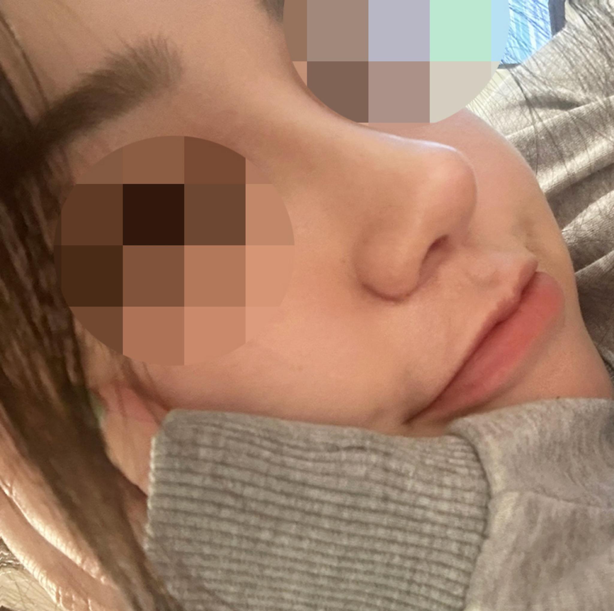 後