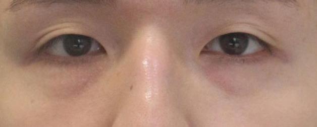 後