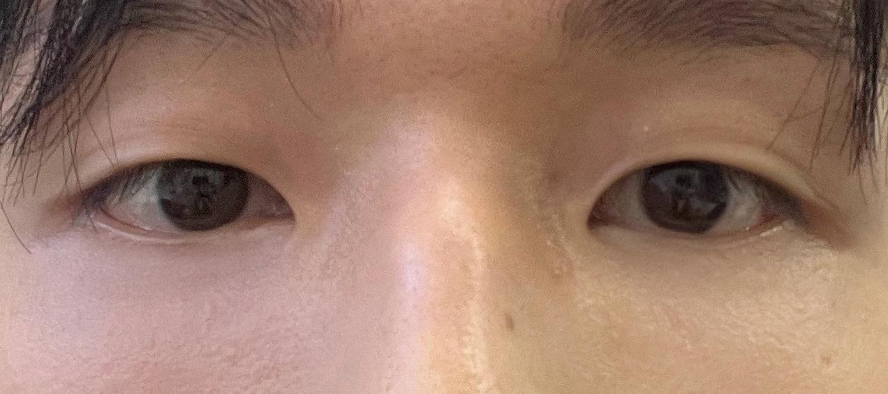 後