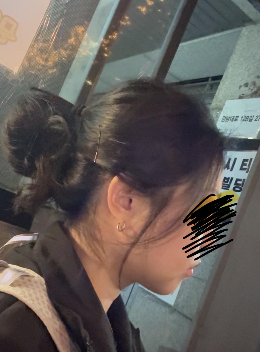 後