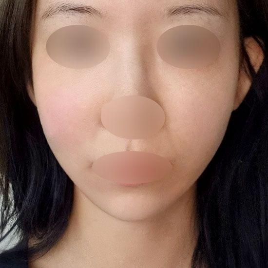 后