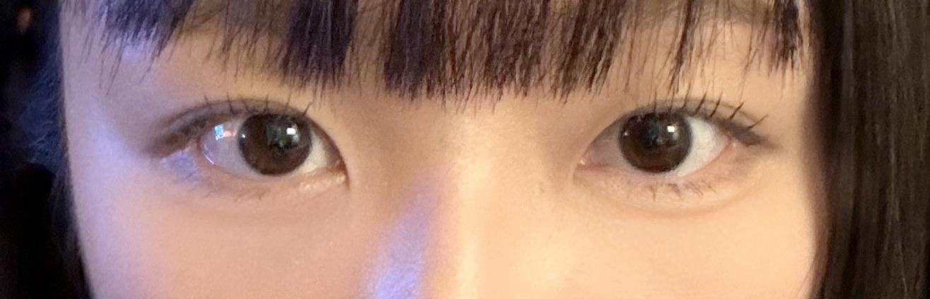 後