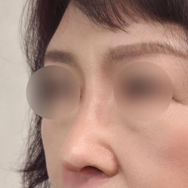後