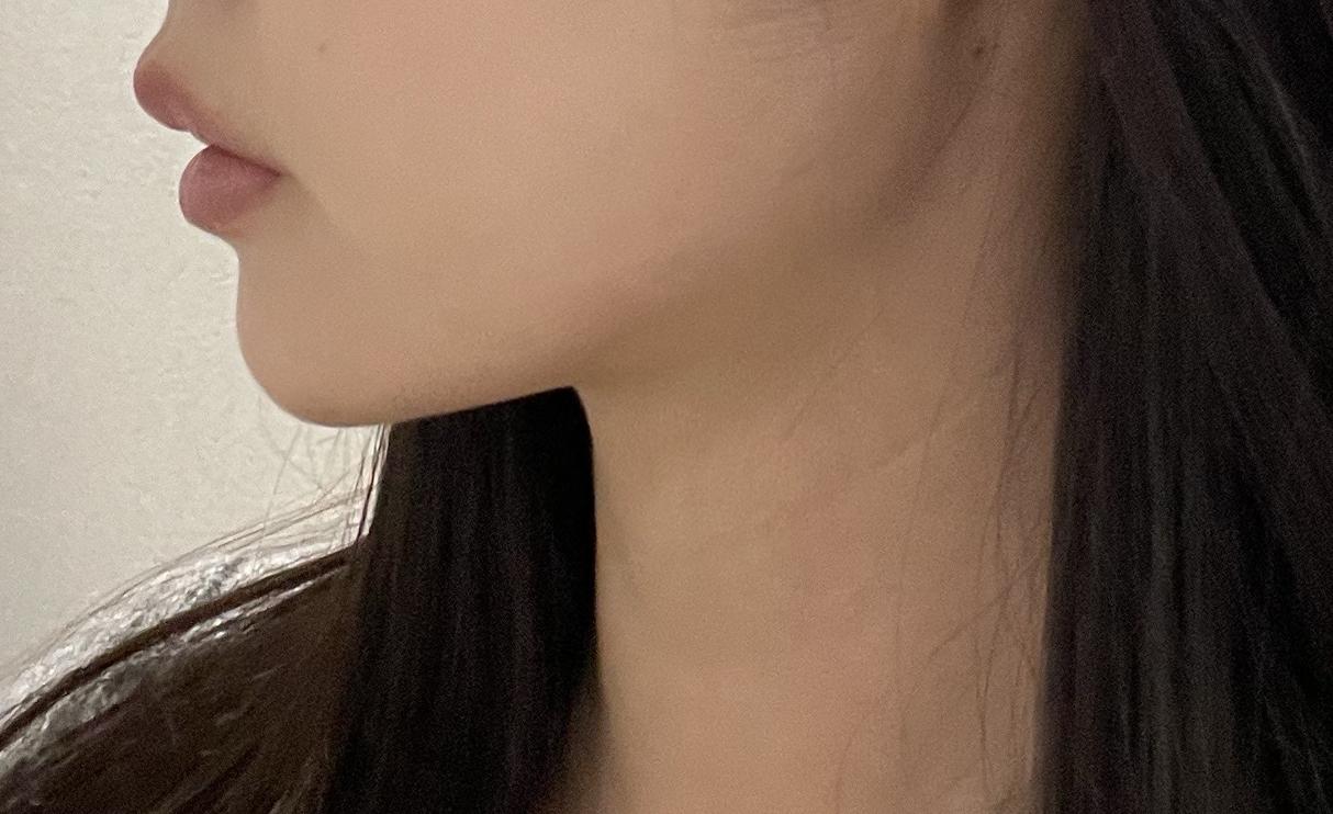 後