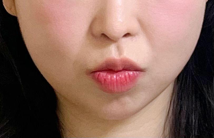後