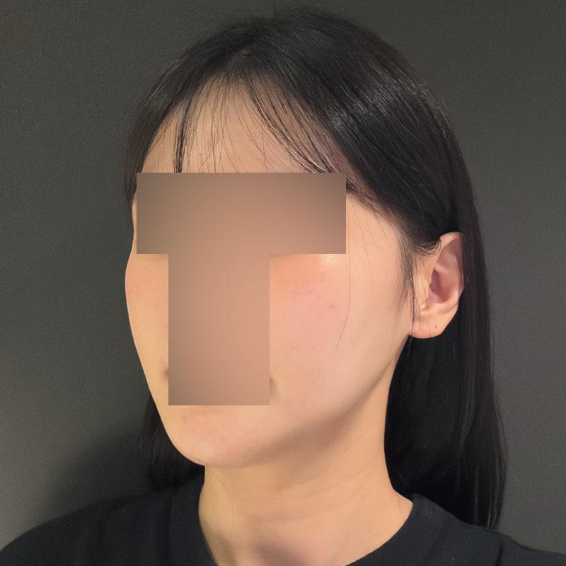 后