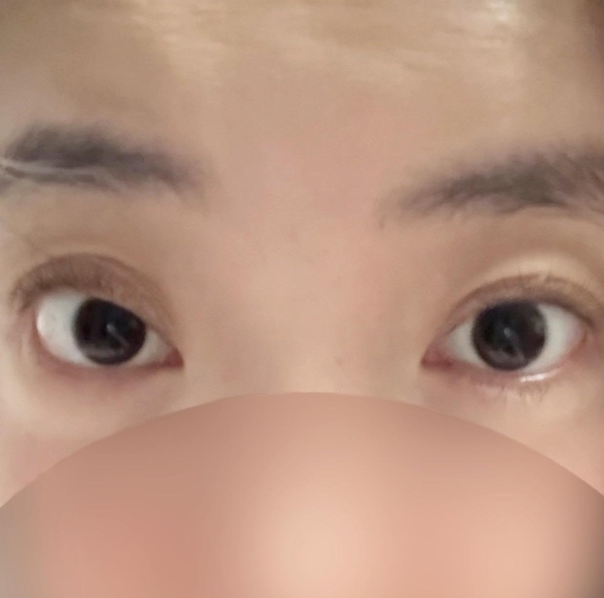後