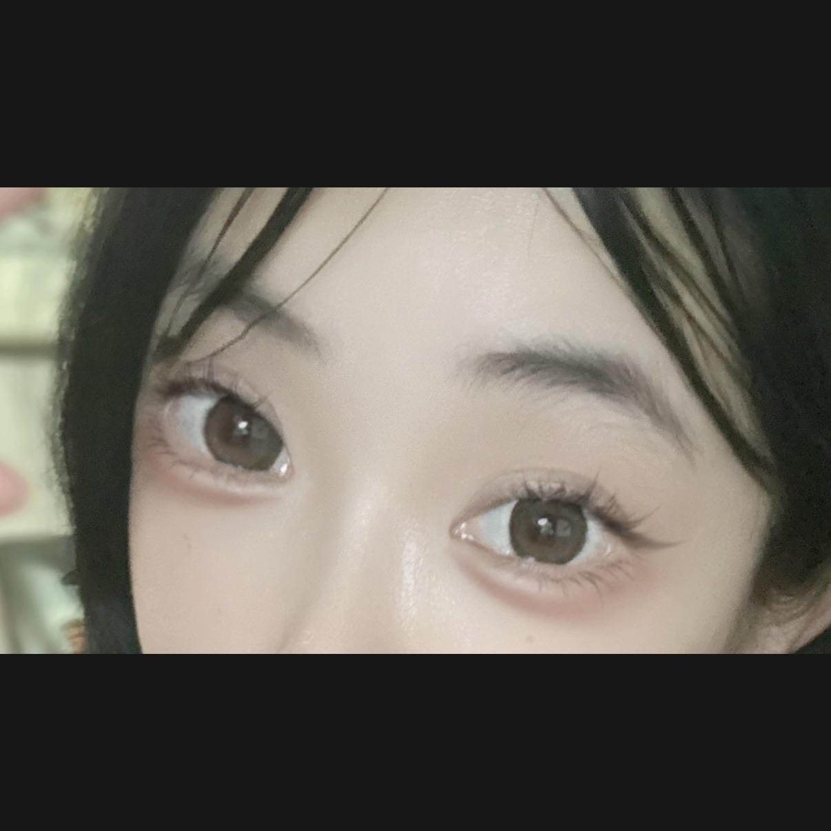 後