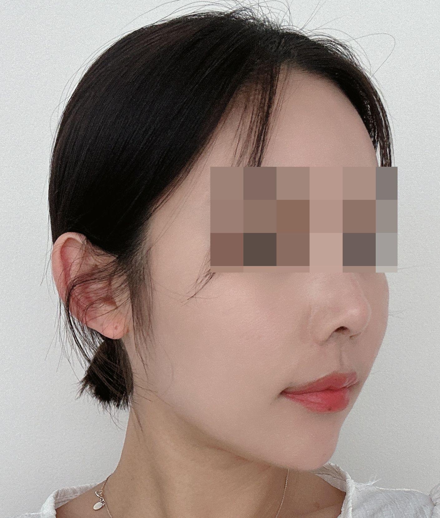 後