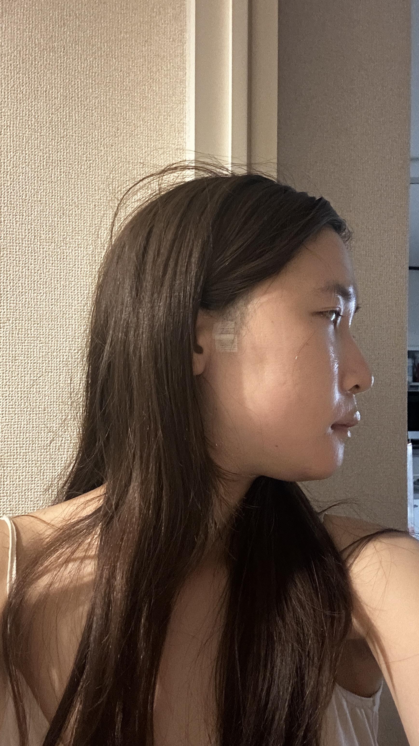 後