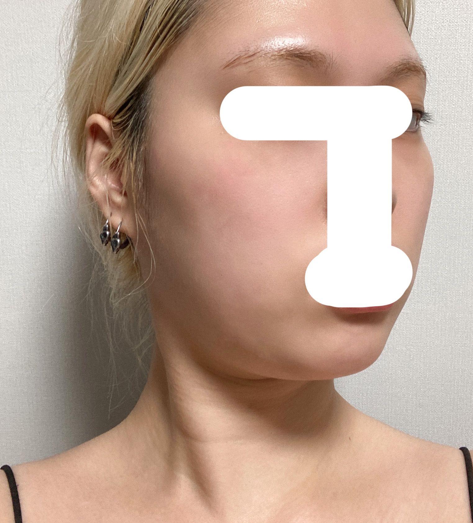 後