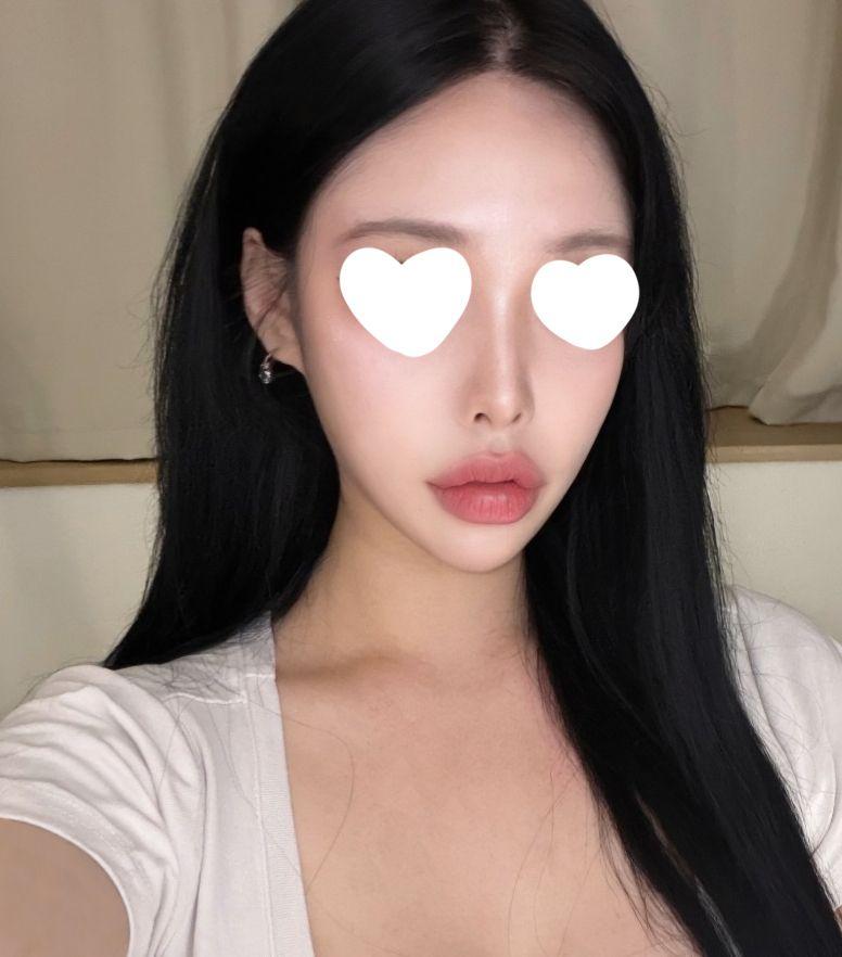 後