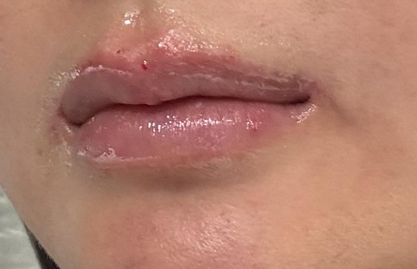 後